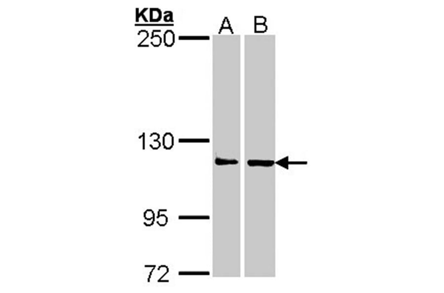 Adenosine Deaminase antibody from Signalway Antibody (22950) - Antibodies.com