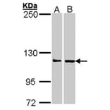Adenosine Deaminase antibody from Signalway Antibody (22950) - Antibodies.com