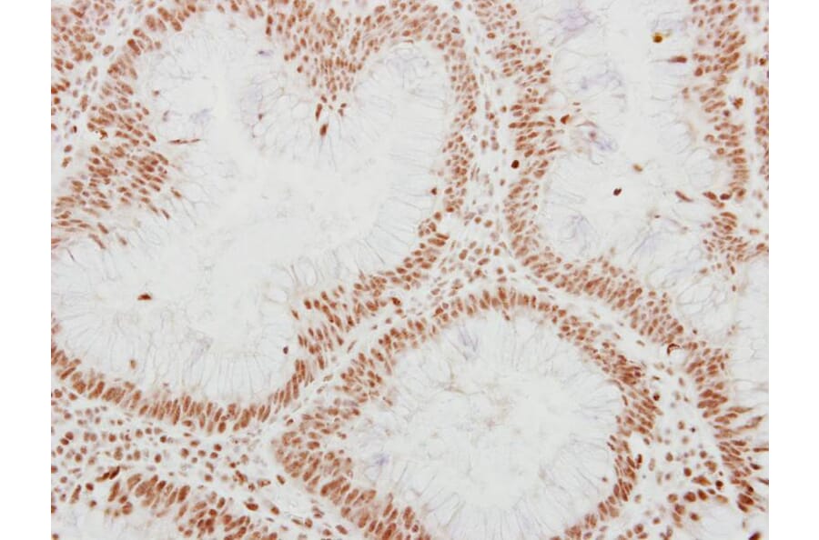 Immunohistochemistry - Adenosine Deaminase antibody from Signalway Antibody (22950) - Antibodies.com
