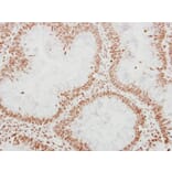 Immunohistochemistry - Adenosine Deaminase antibody from Signalway Antibody (22950) - Antibodies.com