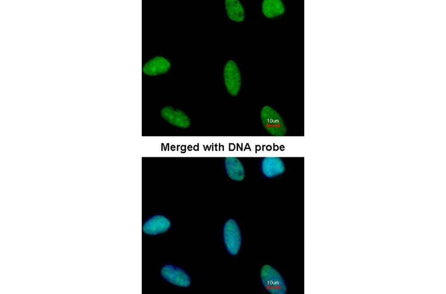 Immunofluorescence - Adenosine Deaminase antibody from Signalway Antibody (22950) - Antibodies.com