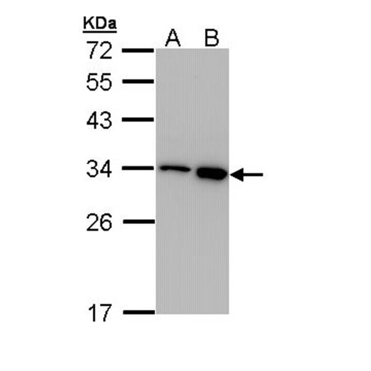 RPA 32 kDa subunit antibody from Signalway Antibody (23069) - Antibodies.com