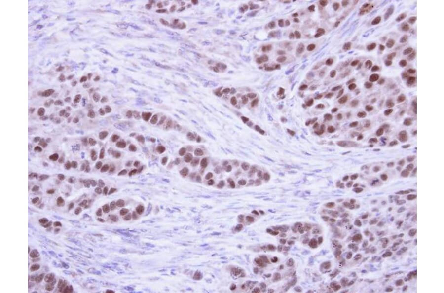 Immunohistochemistry - RPA 32 kDa subunit antibody from Signalway Antibody (23069) - Antibodies.com