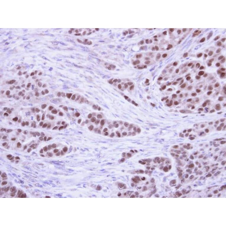 Immunohistochemistry - RPA 32 kDa subunit antibody from Signalway Antibody (23069) - Antibodies.com