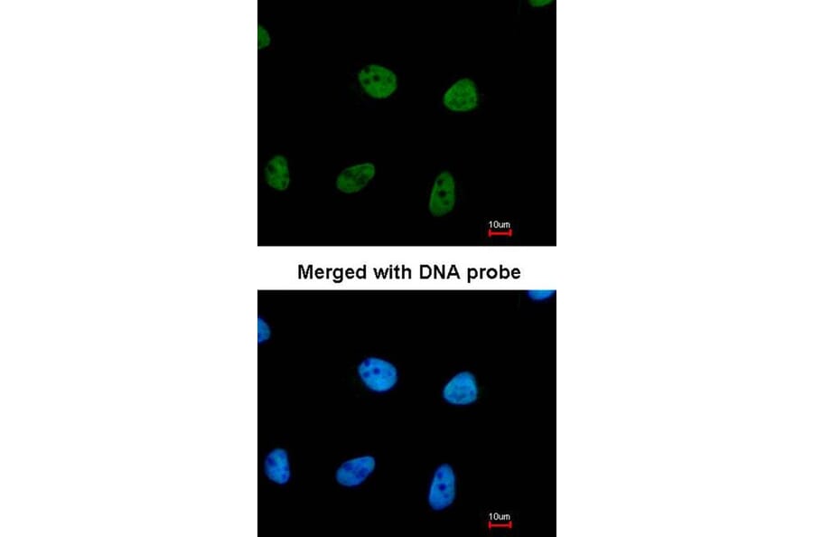 Immunofluorescence - RPA 32 kDa subunit antibody from Signalway Antibody (23069) - Antibodies.com