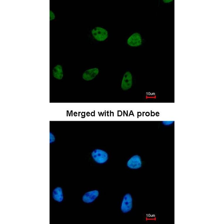 Immunofluorescence - RPA 32 kDa subunit antibody from Signalway Antibody (23069) - Antibodies.com