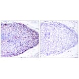 Immunohistochemistry - ATF2 (Ab-62 or 44) Antibody from Signalway Antibody (21029) - Antibodies.com