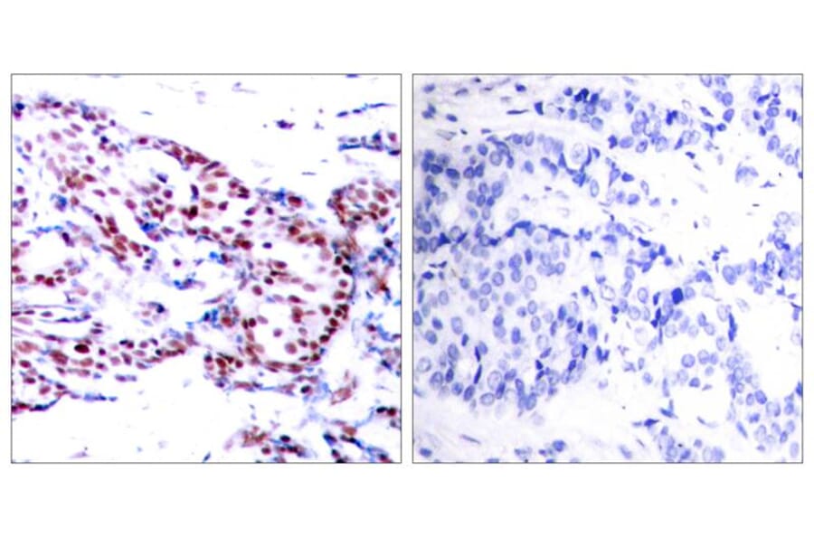 Immunohistochemistry - ATF2 (Ab-71 or 53) Antibody from Signalway Antibody (21031) - Antibodies.com