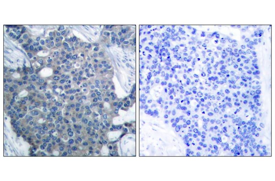Immunohistochemistry - Stathmin1 (Ab-25) Antibody from Signalway Antibody (21217) - Antibodies.com