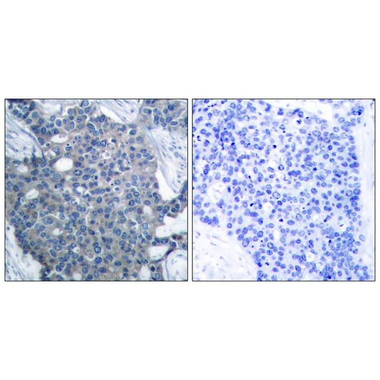 Immunohistochemistry - Stathmin1 (Ab-25) Antibody from Signalway Antibody (21217) - Antibodies.com