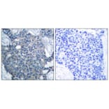 Immunohistochemistry - Stathmin1 (Ab-25) Antibody from Signalway Antibody (21217) - Antibodies.com