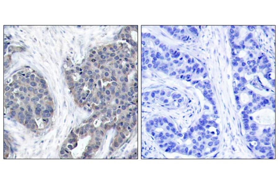 Immunohistochemistry - Stathmin1 (Ab-38) Antibody from Signalway Antibody (21218) - Antibodies.com