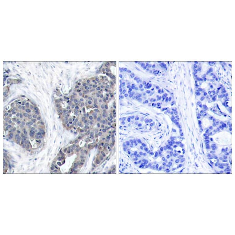 Immunohistochemistry - Stathmin1 (Ab-38) Antibody from Signalway Antibody (21218) - Antibodies.com