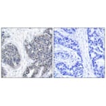 Immunohistochemistry - Stathmin1 (Ab-38) Antibody from Signalway Antibody (21218) - Antibodies.com