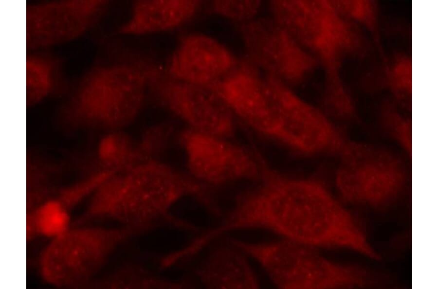 Immunofluorescence - Stathmin1 (Ab-38) Antibody from Signalway Antibody (21218) - Antibodies.com