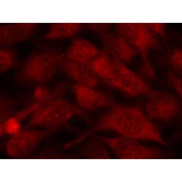 Immunofluorescence - Stathmin1 (Ab-38) Antibody from Signalway Antibody (21218) - Antibodies.com