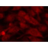 Immunofluorescence - Stathmin1 (Ab-38) Antibody from Signalway Antibody (21218) - Antibodies.com