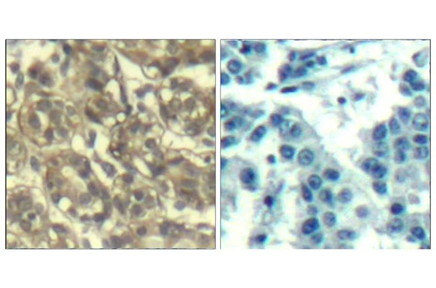 Immunohistochemistry - Cyclin B1 (Ab-147) Antibody from Signalway Antibody (21540) - Antibodies.com