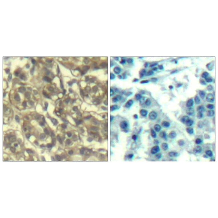 Immunohistochemistry - Cyclin B1 (Ab-147) Antibody from Signalway Antibody (21540) - Antibodies.com