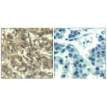 Immunohistochemistry - Cyclin B1 (Ab-147) Antibody from Signalway Antibody (21540) - Antibodies.com