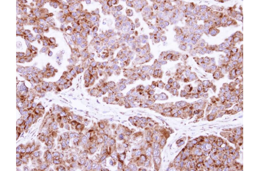 Immunohistochemistry - fumarate hydratase antibody from Signalway Antibody (22079) - Antibodies.com