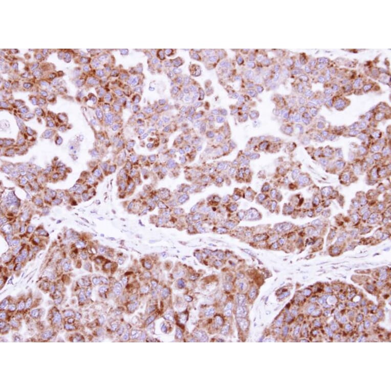 Immunohistochemistry - fumarate hydratase antibody from Signalway Antibody (22079) - Antibodies.com