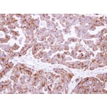 Immunohistochemistry - fumarate hydratase antibody from Signalway Antibody (22079) - Antibodies.com
