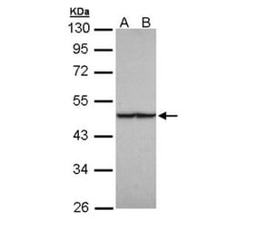 fumarate hydratase antibody from Signalway Antibody (22113) - Antibodies.com