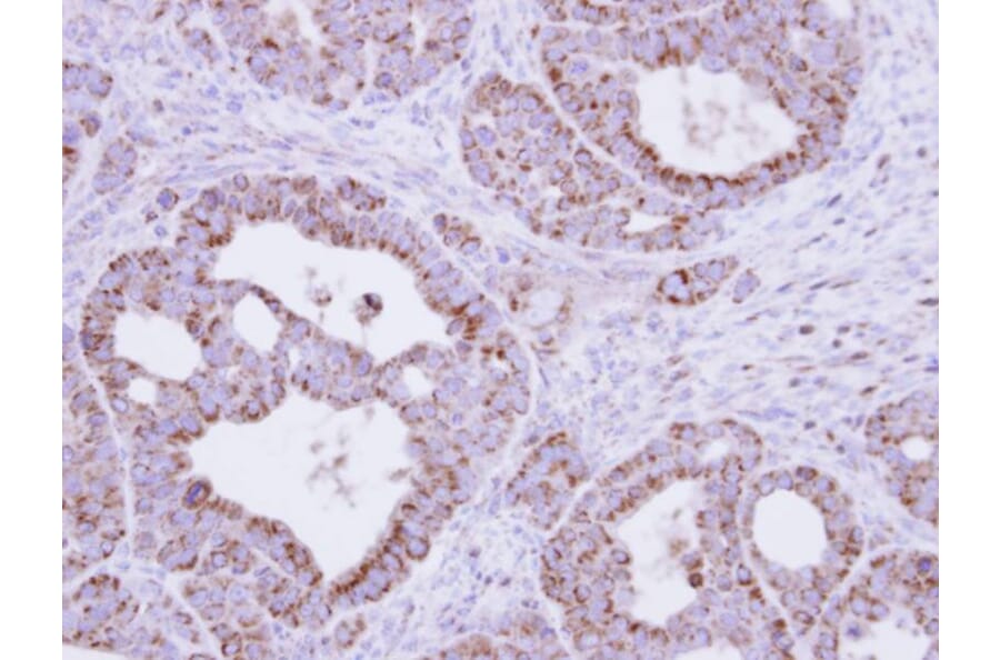 Immunohistochemistry - fumarate hydratase antibody from Signalway Antibody (22113) - Antibodies.com