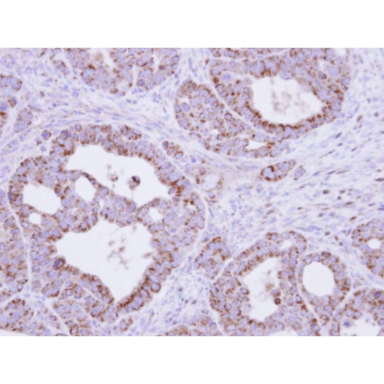 Immunohistochemistry - fumarate hydratase antibody from Signalway Antibody (22113) - Antibodies.com