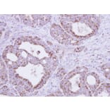 Immunohistochemistry - fumarate hydratase antibody from Signalway Antibody (22113) - Antibodies.com