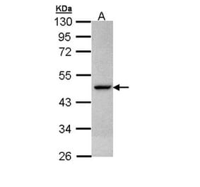 Citrate synthetase antibody from Signalway Antibody (22382) - Antibodies.com