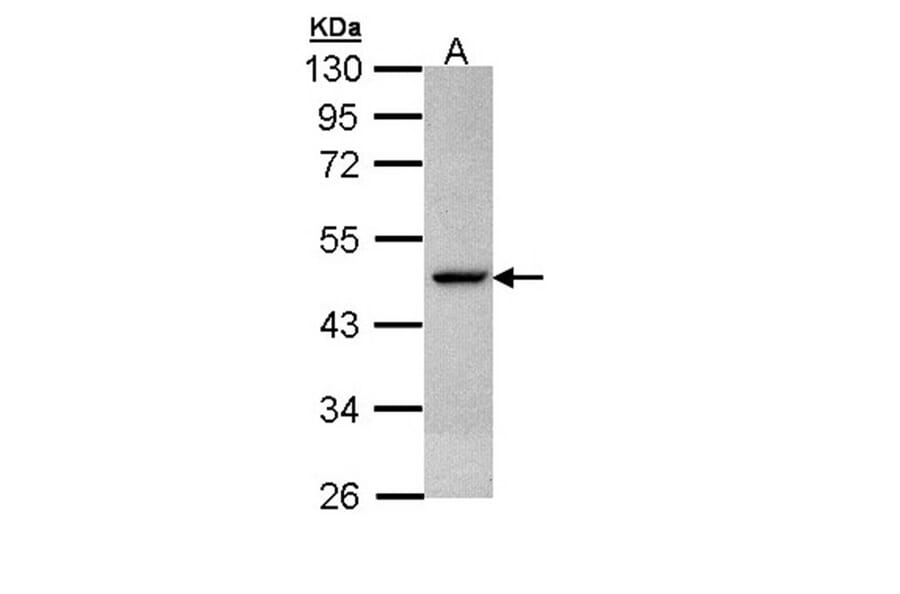 Citrate synthetase antibody from Signalway Antibody (22382) - Antibodies.com