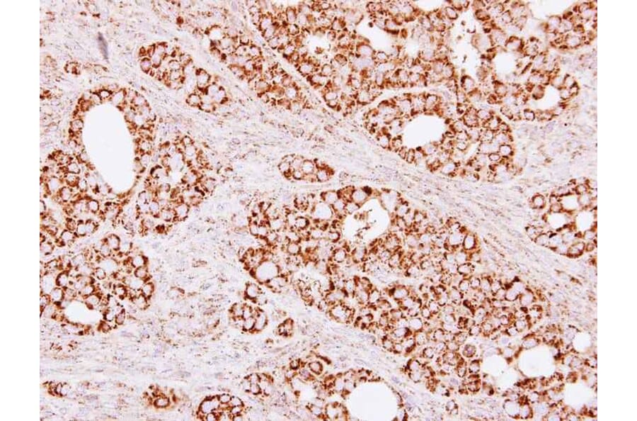 Immunohistochemistry - Citrate synthetase antibody from Signalway Antibody (22382) - Antibodies.com