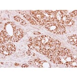 Immunohistochemistry - Citrate synthetase antibody from Signalway Antibody (22382) - Antibodies.com