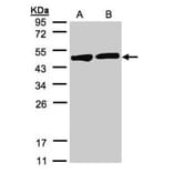 Creatine Kinase BB antibody from Signalway Antibody (22839) - Antibodies.com