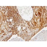 Immunohistochemistry - Creatine Kinase BB antibody from Signalway Antibody (22839) - Antibodies.com