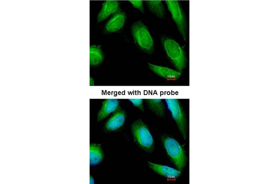 Immunofluorescence - Creatine Kinase BB antibody from Signalway Antibody (22839) - Antibodies.com