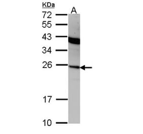 Interferon alpha-2 antibody from Signalway Antibody (23024) - Antibodies.com