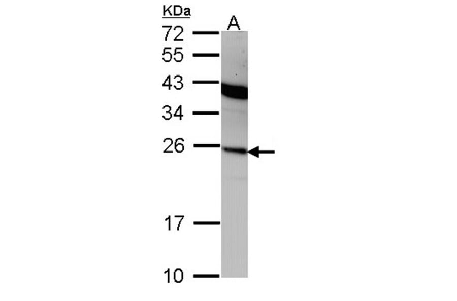 Interferon alpha-2 antibody from Signalway Antibody (23024) - Antibodies.com