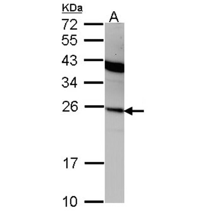 Interferon alpha-2 antibody from Signalway Antibody (23024) - Antibodies.com