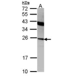 Interferon alpha-2 antibody from Signalway Antibody (23024) - Antibodies.com