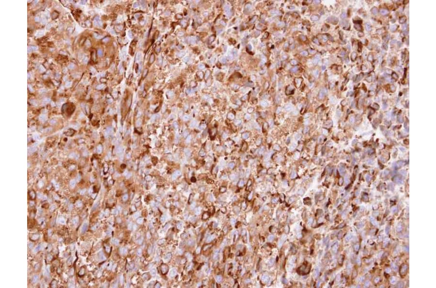 Immunohistochemistry - Interferon alpha-2 antibody from Signalway Antibody (23024) - Antibodies.com