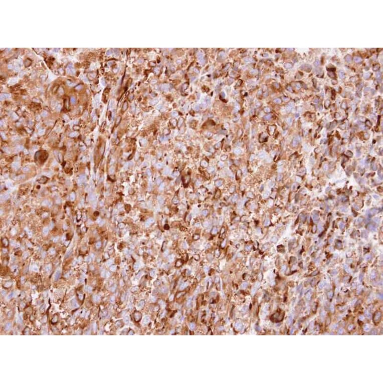 Immunohistochemistry - Interferon alpha-2 antibody from Signalway Antibody (23024) - Antibodies.com
