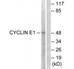 Western blot - Cyclin E1 (Ab-395) Antibody from Signalway Antibody (33122) - Antibodies.com