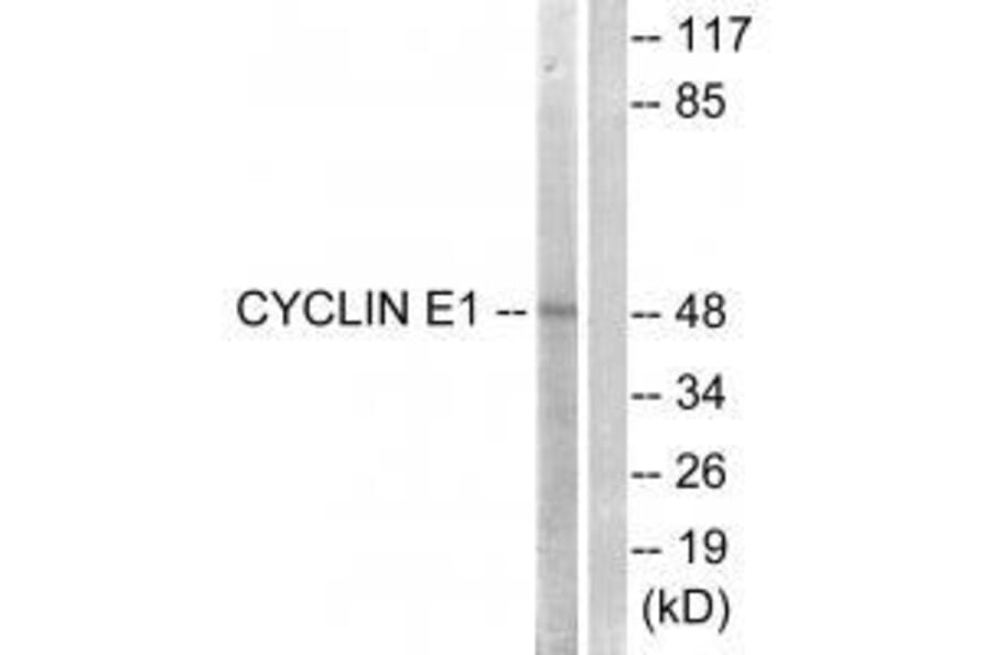 Western blot - Cyclin E1 (Ab-395) Antibody from Signalway Antibody (33122) - Antibodies.com