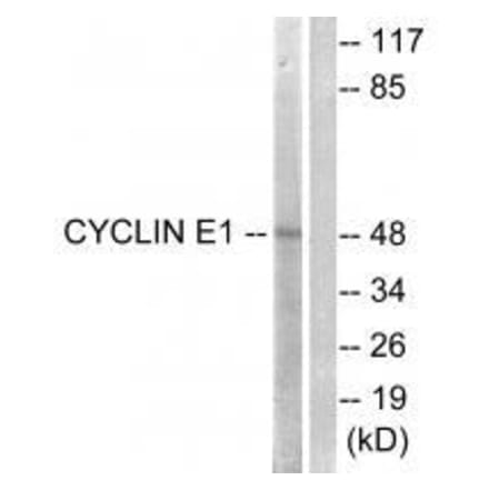 Western blot - Cyclin E1 (Ab-395) Antibody from Signalway Antibody (33122) - Antibodies.com