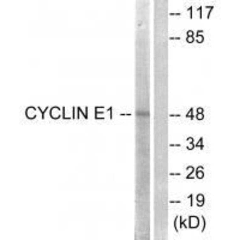 Western blot - Cyclin E1 (Ab-395) Antibody from Signalway Antibody (33122) - Antibodies.com