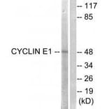 Western blot - Cyclin E1 (Ab-395) Antibody from Signalway Antibody (33122) - Antibodies.com