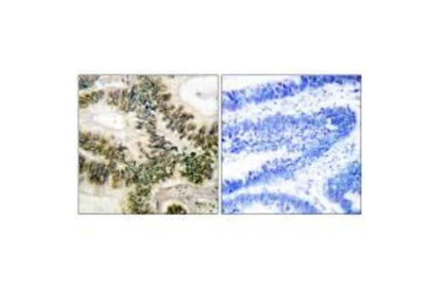Immunohistochemistry - Cyclin E1 (Ab-395) Antibody from Signalway Antibody (33122) - Antibodies.com